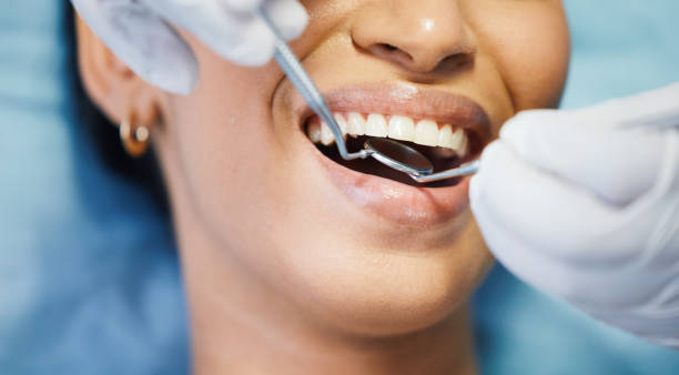 Best Lost Filling or Crown Replacement in Garyville, LA